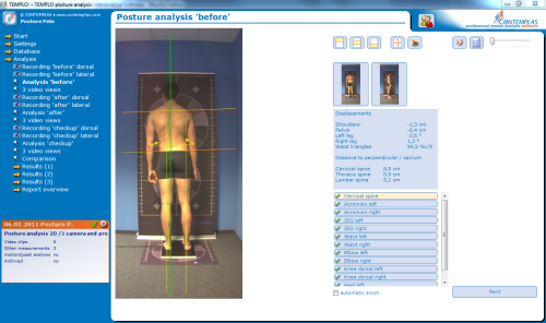 Haltungsanalyse 2D Analyseansicht dorsal