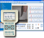 motion analysis