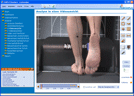Orthopädieschuhtechnik, Orthopädietechnik: Laufanalyse