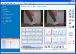 motion analysis